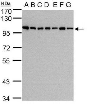 HPS3 Antibody - Sample (30 ug of whole cell lysate). A:293T, B: A431 , C: H1299, D: HeLa S3 , E: Hep G2 . F: MOLT4 . G: Raji . 7.5% SDS PAGE. HPS3 antibody diluted at 1:1000