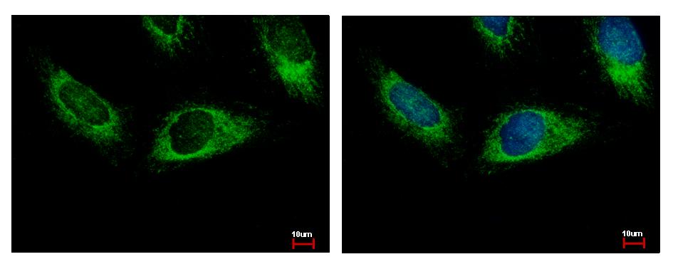 HPS3 Antibody - HPS3 antibody [C3], C-term detects HPS3 protein at cytoplasm by immunofluorescent analysis. HeLa cells were fixed in 4% paraformaldehyde at RT for 15 min. HPS3 protein stained by HPS3 antibody [C3], C-term diluted at 1:500. 