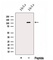 HPS3 Antibody - Western blot analysis of extracts of HeLa cells using HPS3 antibody. The lane on the left was treated with blocking peptide.