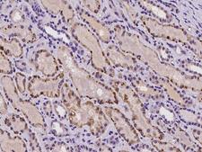 HPS3 Antibody - Immunochemical staining of human HPS3 in human kidney with rabbit polyclonal antibody at 1:100 dilution, formalin-fixed paraffin embedded sections.