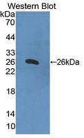 HPS4 Antibody - Western blot of HPS4 antibody.