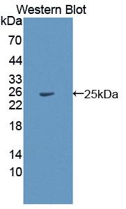 HPS4 Antibody - Western blot of HPS4 antibody.
