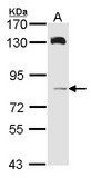 HPS6 Antibody - Sample (30 ug of whole cell lysate). A: A431 . 7.5% SDS PAGE. HPS6 antibody diluted at 1:1000.