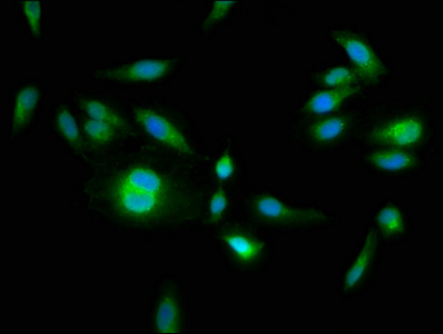 HPS6 Antibody - Immunofluorescence staining of Hela cells at a dilution of 1:133, counter-stained with DAPI. The cells were fixed in 4% formaldehyde, permeabilized using 0.2% Triton X-100 and blocked in 10% normal Goat Serum. The cells were then incubated with the antibody overnight at 4 °C.The secondary antibody was Alexa Fluor 488-congugated AffiniPure Goat Anti-Rabbit IgG (H+L) .