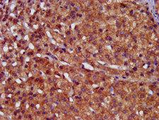 HPS6 Antibody - Immunohistochemistry image at a dilution of 1:400 and staining in paraffin-embedded human adrenal gland tissue performed on a Leica BondTM system. After dewaxing and hydration, antigen retrieval was mediated by high pressure in a citrate buffer (pH 6.0) . Section was blocked with 10% normal goat serum 30min at RT. Then primary antibody (1% BSA) was incubated at 4 °C overnight. The primary is detected by a biotinylated secondary antibody and visualized using an HRP conjugated SP system.