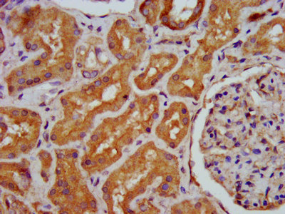 HPS6 Antibody - Immunohistochemistry image at a dilution of 1:400 and staining in paraffin-embedded human kidney tissue performed on a Leica BondTM system. After dewaxing and hydration, antigen retrieval was mediated by high pressure in a citrate buffer (pH 6.0) . Section was blocked with 10% normal goat serum 30min at RT. Then primary antibody (1% BSA) was incubated at 4 °C overnight. The primary is detected by a biotinylated secondary antibody and visualized using an HRP conjugated SP system.