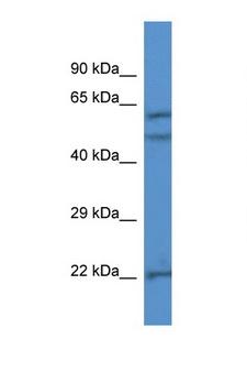 HPSE / Heparanase Antibody - HPSE / Heparanase antibody western blot of Jurkat Cell lysate. Antibody concentration 1 ug/ml.  This image was taken for the unconjugated form of this product. Other forms have not been tested.