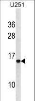 HPSE / Heparanase Antibody - HPSE Antibody western blot of U251 cell line lysates (35 ug/lane). The HPSE antibody detected the HPSE protein (arrow).