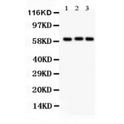 HPSE / Heparanase Antibody - Heparanase 1 antibody Western blot. All lanes: Anti Heparanase 1 at 0.5 ug/ml. Lane 1: Rat Liver Tissue Lysate at 50 ug. Lane 2: Human Placenta Tissue Lysate at 50 ug. Lane 3: A549 Whole Cell Lysate at 40 ug. Predicted band size: 61 kD. Observed band size: 61 kD.