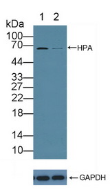 HPSE / Heparanase Antibody - Knockout Varification: Lane 1: Wild-type HepG2 cell lysate; Lane 2: HPA knockout HepG2 cell lysate; Predicted MW: 43,53,55,61kd Observed MW: 68kd Primary Ab: 1µg/ml Rabbit Anti-Human HPA Antibody Second Ab: 0.2µg/mL HRP-Linked Caprine Anti-Rabbit IgG Polyclonal Antibody