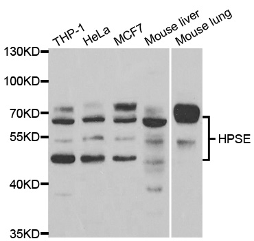 HPSE / Heparanase Antibody - Western blot analysis of extracts of various cell lines, using HPSE antibody.