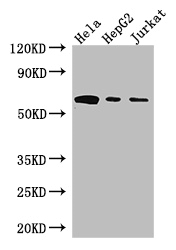 HPSE / Heparanase Antibody - Positive WB detected in:Hela whole cell lysate,HepG2 whole cell lysate,Jurkat whole cell lysate;All lanes: HPSE antibody at 3ug/ml;Secondary;Goat polyclonal to rabbit IgG at 1/50000 dilution;Predicted band size: 62,55,54,43 kDa;Observed band size: 62 kDa;