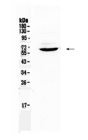 HPSE / Heparanase Antibody - Western blot - Anti-Heparanase 1 Picoband Antibody