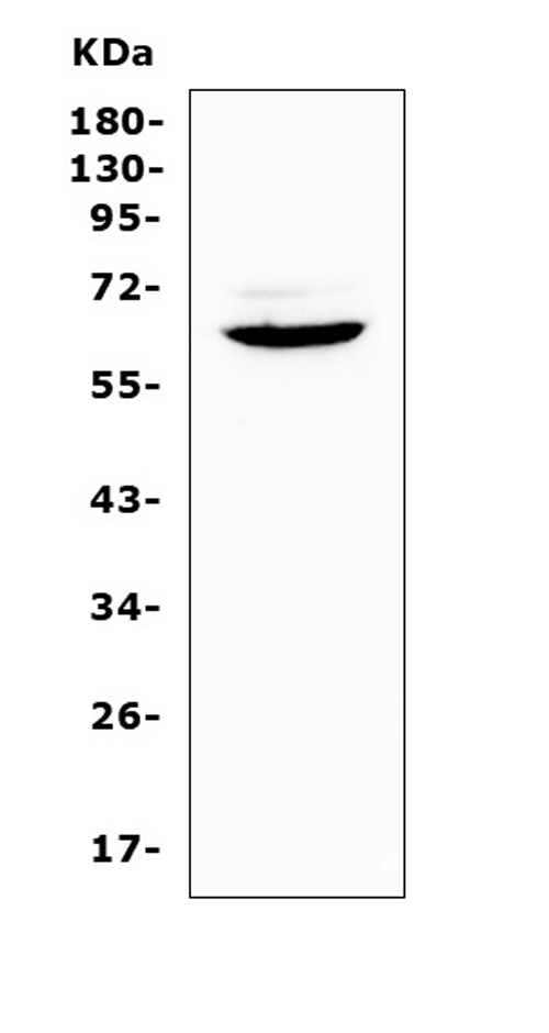 HPSE / Heparanase Antibody - Western blot analysis of Heparanase 1 using anti-Heparanase 1 antibody. Electrophoresis was performed on a 5-20% SDS-PAGE gel at 70V (Stacking gel) / 90V (Resolving gel) for 2-3 hours. The sample well of each lane was loaded with 50ug of sample under reducing conditions. Lane 1: mouse spleen tissue lysates. After Electrophoresis, proteins were transferred to a Nitrocellulose membrane at 150mA for 50-90 minutes. Blocked the membrane with 5% Non-fat Milk/ TBS for 1.5 hour at RT. The membrane was incubated with rabbit anti-Heparanase 1 antigen affinity purified polyclonal antibody at 0.5 µg/mL overnight at 4°C, then washed with TBS-0.1% Tween 3 times with 5 minutes each and probed with a goat anti-rabbit IgG-HRP secondary antibody at a dilution of 1:10000 for 1.5 hour at RT. The signal is developed using an Enhanced Chemiluminescent detection (ECL) kit with Tanon 5200 system. A specific band was detected for Heparanase 1 at approximately 65KD. The expected band size for Heparanase 1 is at 61KD.