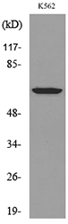 HPSE / Heparanase Antibody - Western blot analysis of lysate from K562 cells, using HPSE Antibody.