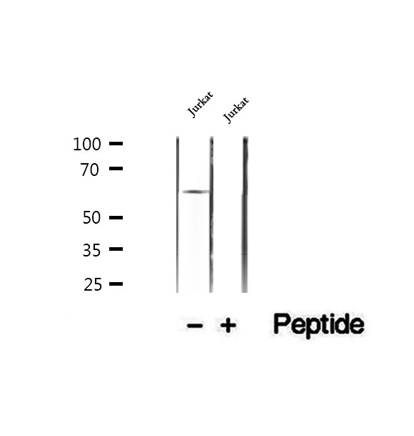 HPSE / Heparanase Antibody - Western blot analysis of extracts of Jurkat cells using HPSE antibody.