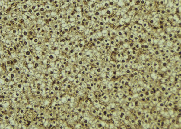 HPSE / Heparanase Antibody - 1:100 staining mouse liver tissue by IHC-P. The sample was formaldehyde fixed and a heat mediated antigen retrieval step in citrate buffer was performed. The sample was then blocked and incubated with the antibody for 1.5 hours at 22°C. An HRP conjugated goat anti-rabbit antibody was used as the secondary.