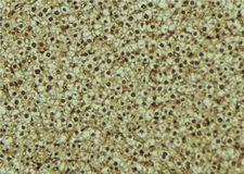 HPSE / Heparanase Antibody - 1:100 staining mouse liver tissue by IHC-P. The sample was formaldehyde fixed and a heat mediated antigen retrieval step in citrate buffer was performed. The sample was then blocked and incubated with the antibody for 1.5 hours at 22°C. An HRP conjugated goat anti-rabbit antibody was used as the secondary.