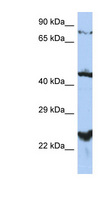 HPT / MRS2L Antibody - MRS2 / MRS2L antibody Western blot of PANC1 cell lysate. This image was taken for the unconjugated form of this product. Other forms have not been tested.