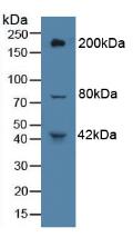 HPTPB / PTPRB Antibody - Western Blot; Sample: Rat Liver Tissue.