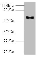 HPV L1 Capsid Antibody - Western blot All lanes: Major capsid protein L1 antibody at 2µg/ml + 293T whole cell lysate Secondary Goat polyclonal to rabbit IgG at 1/10000 dilution Predicted band size: 62 kDa Observed band size: 62 kDa