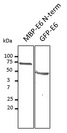 HPV11 E6 Antibody - Western blot. Anti-HPV11 E6 antibody at 1:1000 dilution. MBP-E6 N-term recombinant protein and HEK293 transfected cell lysates at 100 ug per lane. Rabbit polyclonal to goat IgG (HRP) at 1:10000 dilution.