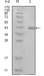 HPV11 E7 Antibody - Western blot using E7 mouse monoclonal antibody against truncated GST-E7 recombinant protein (1).