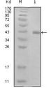 HPV11 E7 Antibody - HPV Type 16 E7 Antibody in Western Blot (WB)
