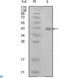 HPV11 E7 Antibody - Western Blot (WB) analysis using E7 Monoclonal Antibody against truncated GST-E7 recombinant protein (1).