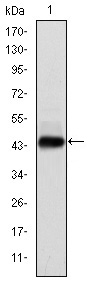 HPV11 E7 Antibody - Western blot using E7 monoclonal antibody against human E7 (AA: 1-98) recombinant protein.