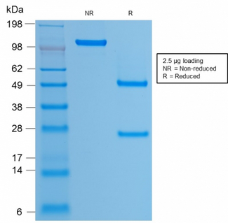 HPV16 L1 Antibody - SDS-PAGE Analysis Purified HPV-16 Mouse Recombinant Monoclonal Antibody (rHPV16L1/1058). Confirmation of Purity and Integrity of Antibody.