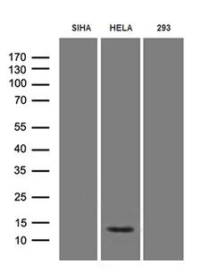 HPV18 E7 Antibody - Western blot analysis of extracts. (35ug) from three different cell lysates by using anti-HPV18 E7 monoclonal antibody. (1:500)