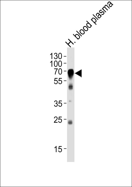 HPX / Hemopexin Antibody - Western blot of lysate from human blood plasma tissue lysate, using HPX Antibody. Antibody was diluted at 1:1000 at each lane. A goat anti-rabbit IgG H&L (HRP) at 1:5000 dilution was used as the secondary antibody. Lysate at 35ug per lane.