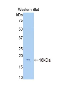 HPX / Hemopexin Antibody - Western blot of HPX / Hemopexin antibody.