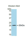 HPX / Hemopexin Antibody - Western blot of recombinant HPX / Hemopexin.  This image was taken for the unconjugated form of this product. Other forms have not been tested.