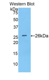 HPX / Hemopexin Antibody - Western blot of recombinant HPX / Hemopexin.  This image was taken for the unconjugated form of this product. Other forms have not been tested.