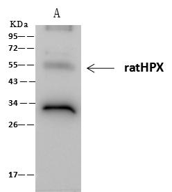HPX / Hemopexin Antibody - ratHPX was immunoprecipitated using: Lane A: 0.5 mg HepG2 Whole Cell Lysate. 2 uL anti-ratHPX rabbit monoclonal antibody and 60 ug of Immunomagnetic beads Protein A/G. Primary antibody: Anti-ratHPX rabbit monoclonal antibody, at 1:100 dilution. Secondary antibody: Clean-Blot IP Detection Reagent (HRP) at 1:1000 dilution. Developed using the ECL technique. Performed under reducing conditions. Predicted band size: 52 kDa. Observed band size: 52 kDa.