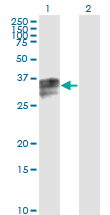 HPX / Hemopexin Antibody - Western Blot analysis of HPX expression in transfected 293T cell line by HPX monoclonal antibody (M01), clone 3A9-1A9.Lane 1: HPX transfected lysate (Predicted MW: 28.6 KDa).Lane 2: Non-transfected lysate.