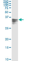 HPX / Hemopexin Antibody - Immunoprecipitation of HPX transfected lysate using anti-HPX monoclonal antibody and Protein A Magnetic Bead, and immunoblotted with HPX rabbit polyclonal antibody.