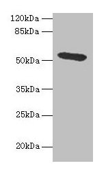 HPX / Hemopexin Antibody - Western blot All lanes: HPX antibody at 4.5µg/ml + HepG2 whole cell lysate Secondary Goat polyclonal to rabbit IgG at 1/10000 dilution Predicted band size: 51 kDa Observed band size: 51 kDa
