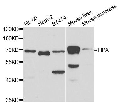 HPX / Hemopexin Antibody - Western blot analysis of extracts of various cell lines.