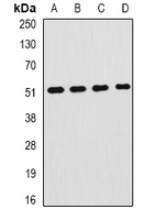 HPX / Hemopexin Antibody - Western blot analysis of Hemopexin expression in HepG2 (A); BT474 (B); mouse liver (C); mouse pancreas (D) whole cell lysates.