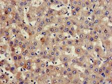HPX / Hemopexin Antibody - Immunohistochemistry of paraffin-embedded human liver tissue using HPX Antibody at dilution of 1:100