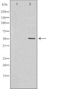 HPX / Hemopexin Antibody - Western blot analysis of HeLa cell lysates using HPX antibody. The lane on the left is treated with the antigen-specific peptide.