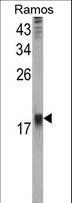 HR6B / UBE2B Antibody - Western blot of UBE2B Antibody in Ramos cell line lysates (35 ug/lane). UBE2B (arrow) was detected using the purified antibody.
