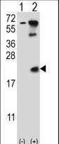 HR6B / UBE2B Antibody - Western blot of UBE2B (arrow) using rabbit polyclonal UBE2B Antibody (E132). 293 cell lysates (2 ug/lane) either nontransfected (Lane 1) or transiently transfected (Lane 2) with the UBE2B gene.