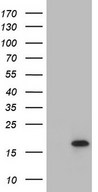HR6B / UBE2B Antibody - HEK293T cells were transfected with the pCMV6-ENTRY control (Left lane) or pCMV6-ENTRY UBE2B (Right lane) cDNA for 48 hrs and lysed. Equivalent amounts of cell lysates (5 ug per lane) were separated by SDS-PAGE and immunoblotted with anti-UBE2B.