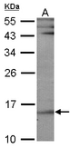 HR6B / UBE2B Antibody - Sample (30 ug of whole cell lysate). A: NIH-3T3 12% SDS PAGE. UBE2B antibody diluted at 1:1000. 