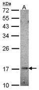 HR6B / UBE2B Antibody - Sample (30 ug of whole cell lysate). A: Hela. 12% SDS PAGE. UBE2B antibody. UBE2B antibody diluted at 1:1000. 