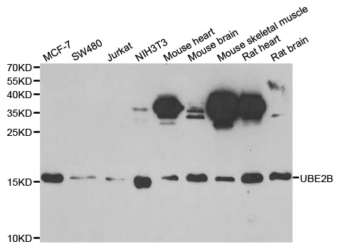 HR6B / UBE2B Antibody - Western blot analysis of extracts of various cell lines.